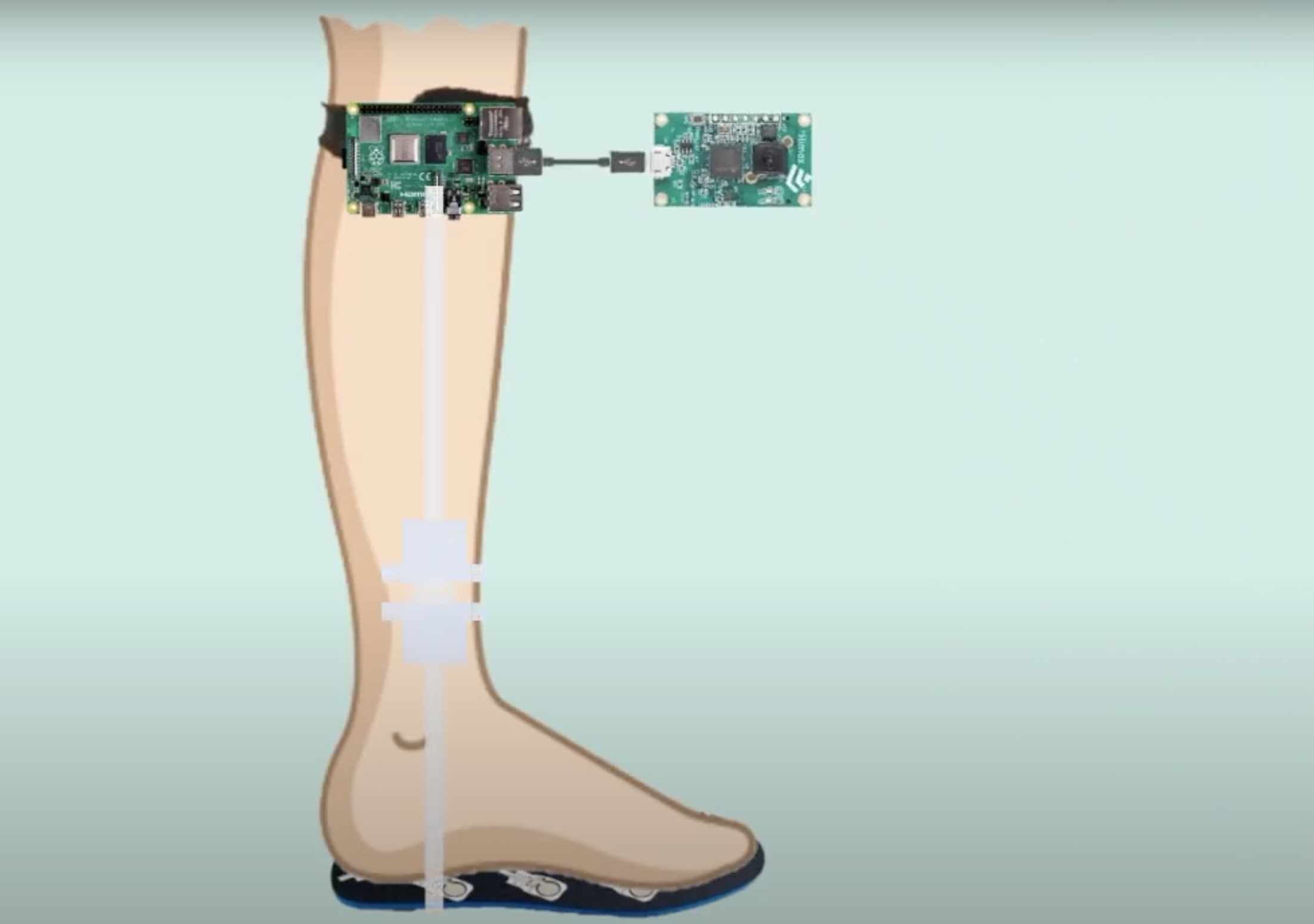 raspberry pi strapped to user's knee to detect Parkinson's Disease
