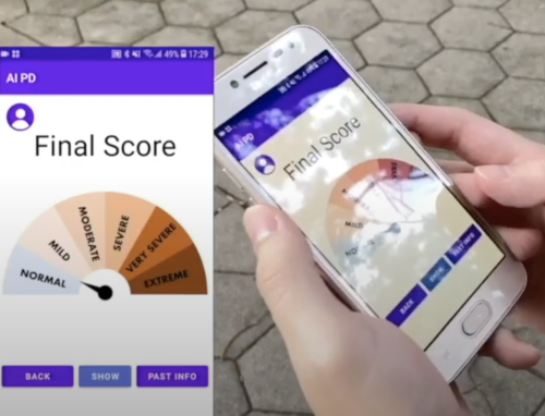 parksinson's detector